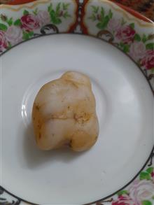 سنگ