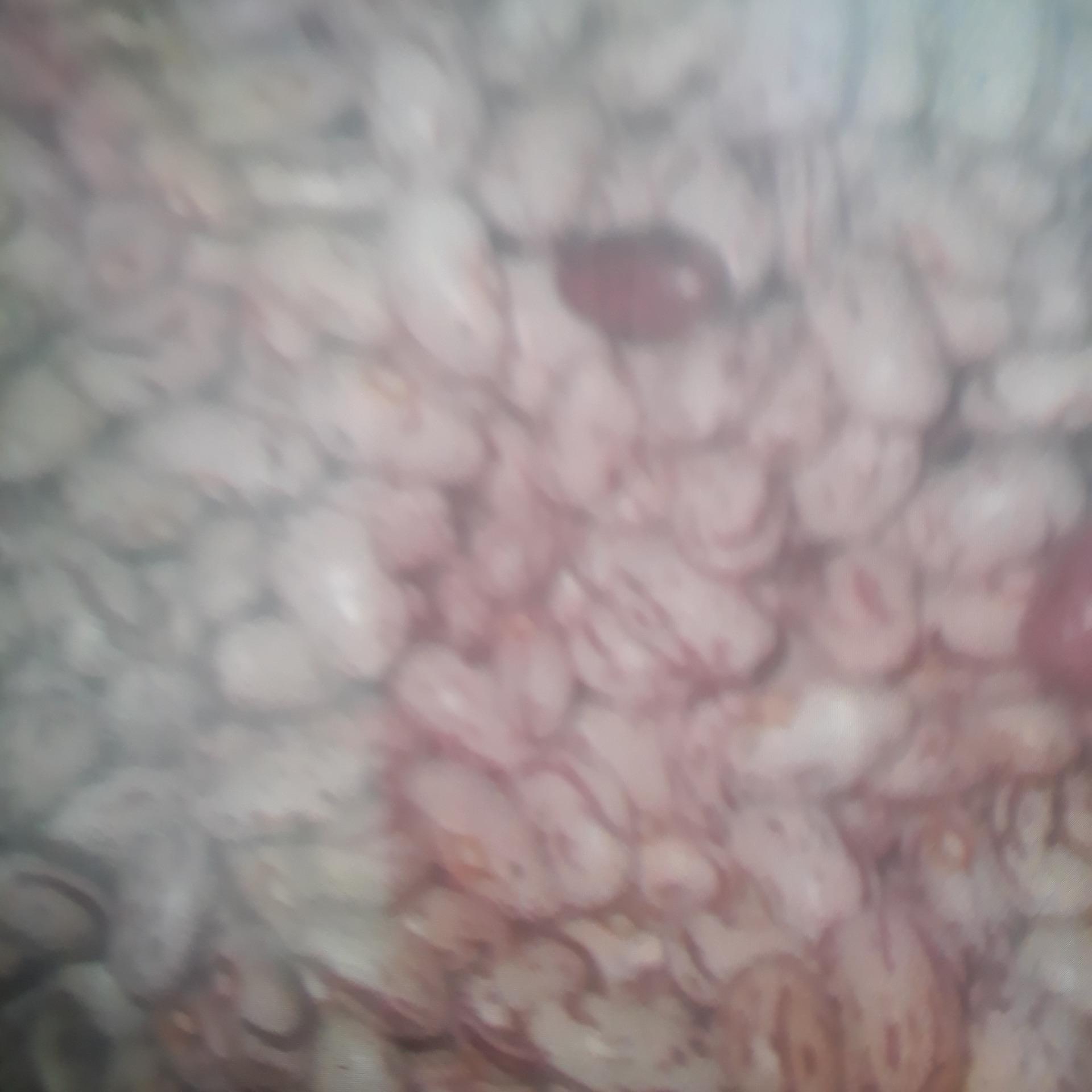 لوبیا چیتی امسال