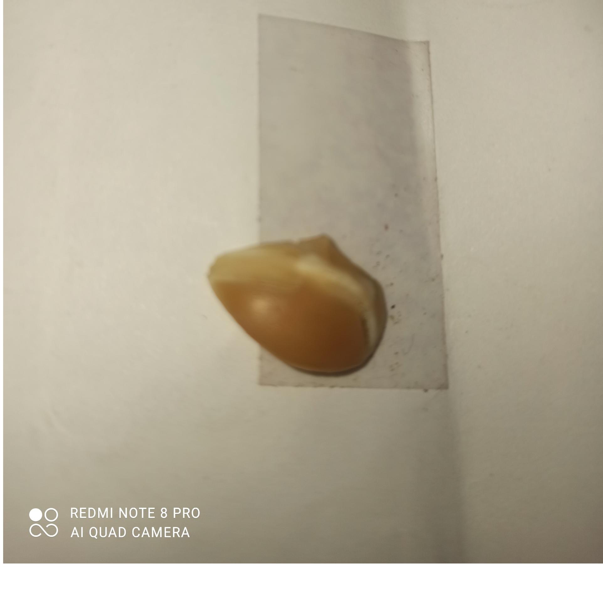 مروارید داروک ص