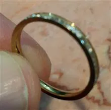 حلقه