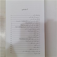 ناخن