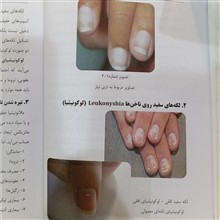 ناخن