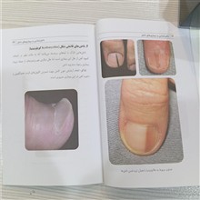 ناخن