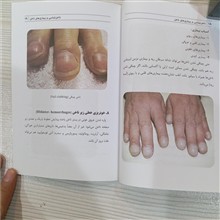 ناخن
