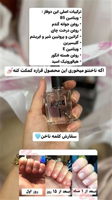 لوسیون