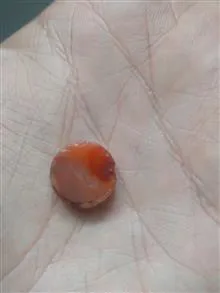 مهره