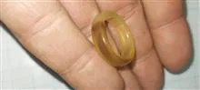 حلقه
