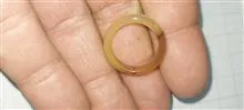 حلقه