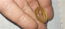 حلقه
